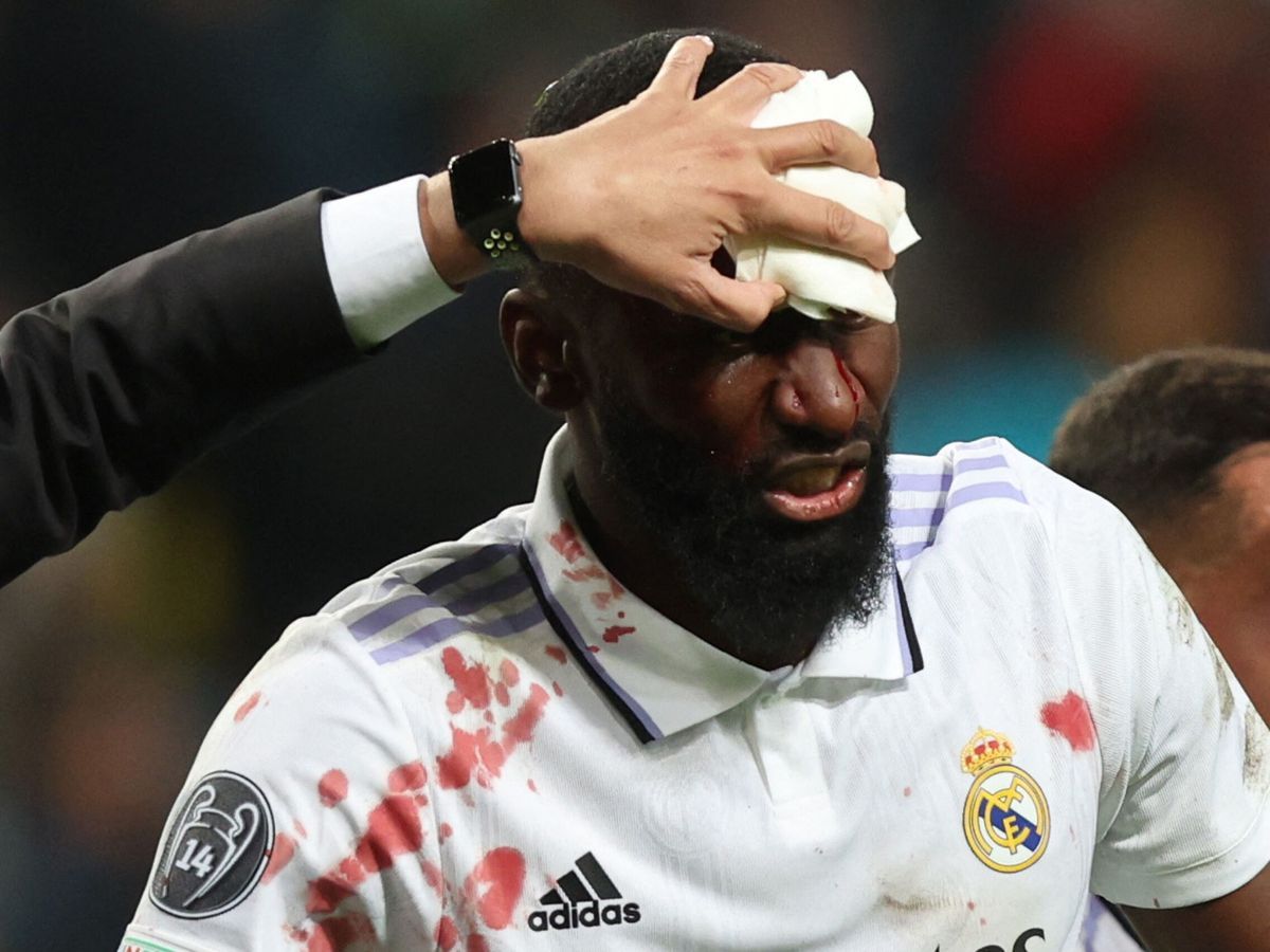 Rüdiger rescató un punto para el Real Madrid y a él le tuvieron que dar 20