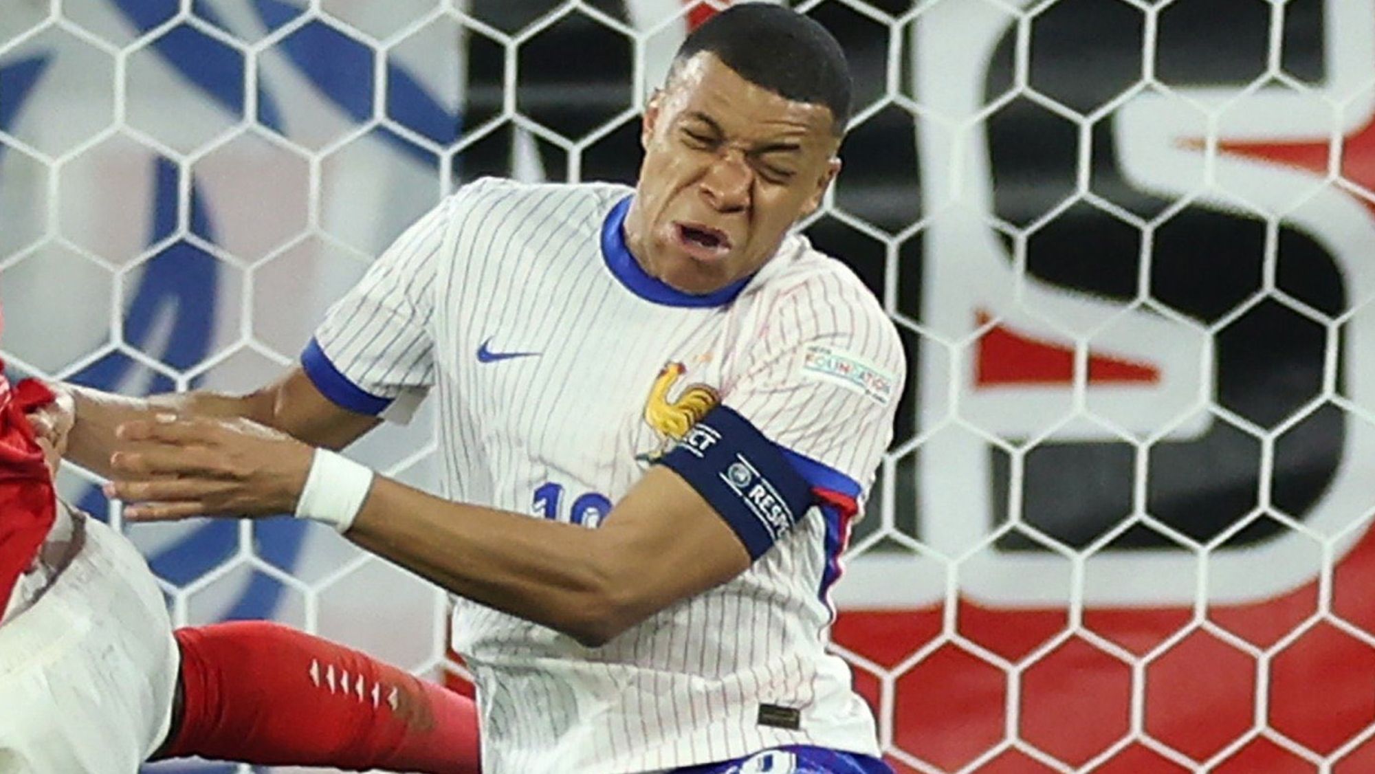 Mbappé podría perderse la Eurocopa y habla el entrenador de Francia: "Su nariz..."