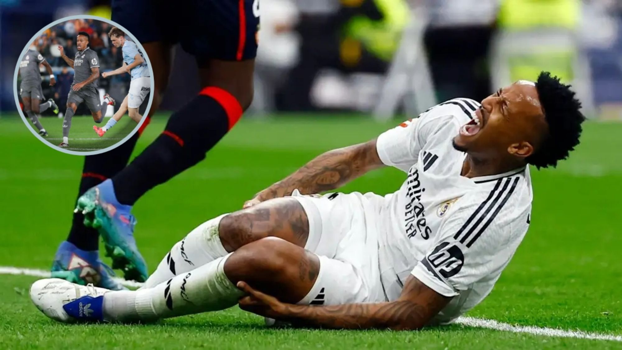 Éder Militan, gravemente lesionado de su rodilla derecha, se perderá lo que queda de temporada con el Real Madrid. Éder Militan, gravemente lesionado de su rodilla derecha, se perderá lo que queda de temporada con el Real Madrid.