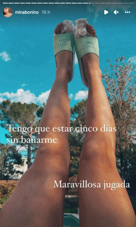 Mina Bonino tras la operación en los pies Mina Bonino tras la operación en los pies