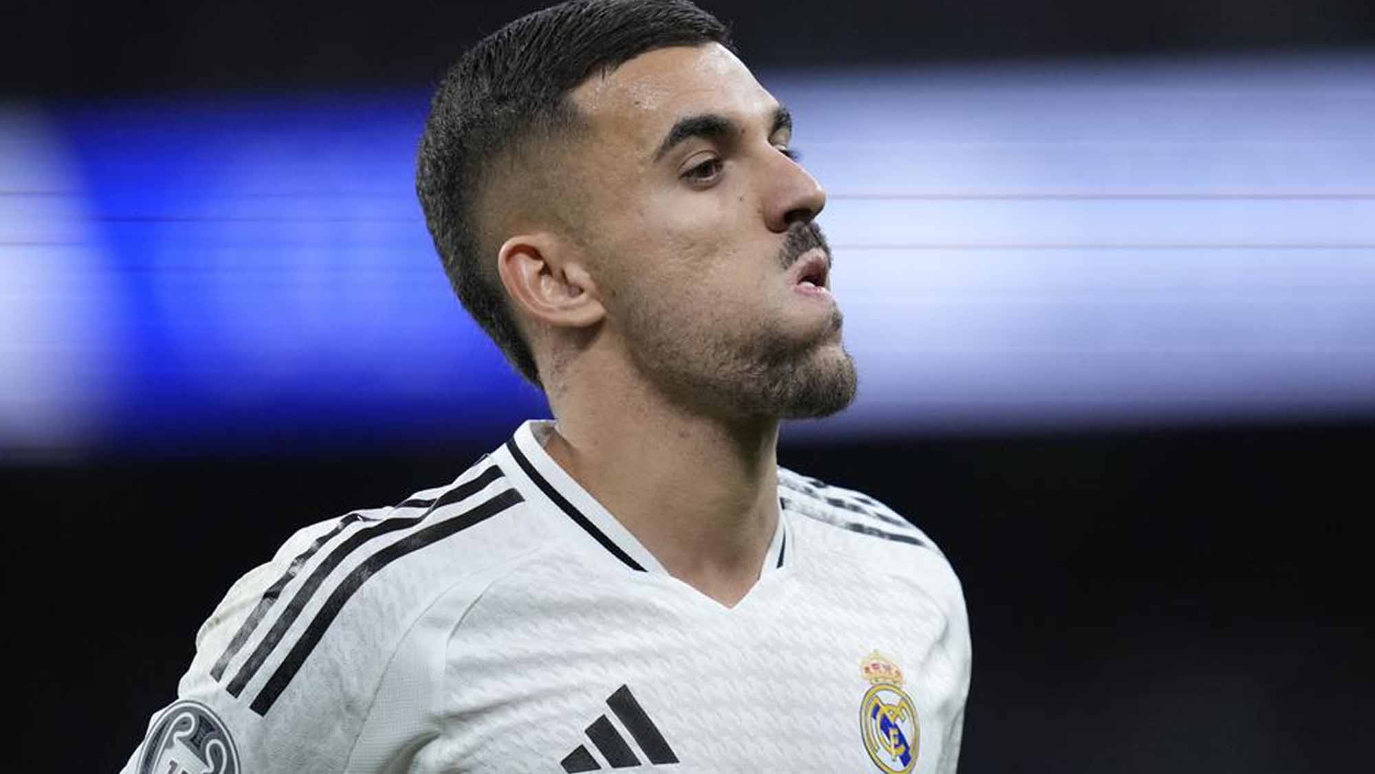 Ceballos haciendo una mueca en partido Ceballos haciendo una mueca en partido