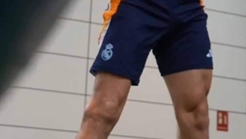 Diferencia muscular de Carvajal Diferencia muscular de Carvajal