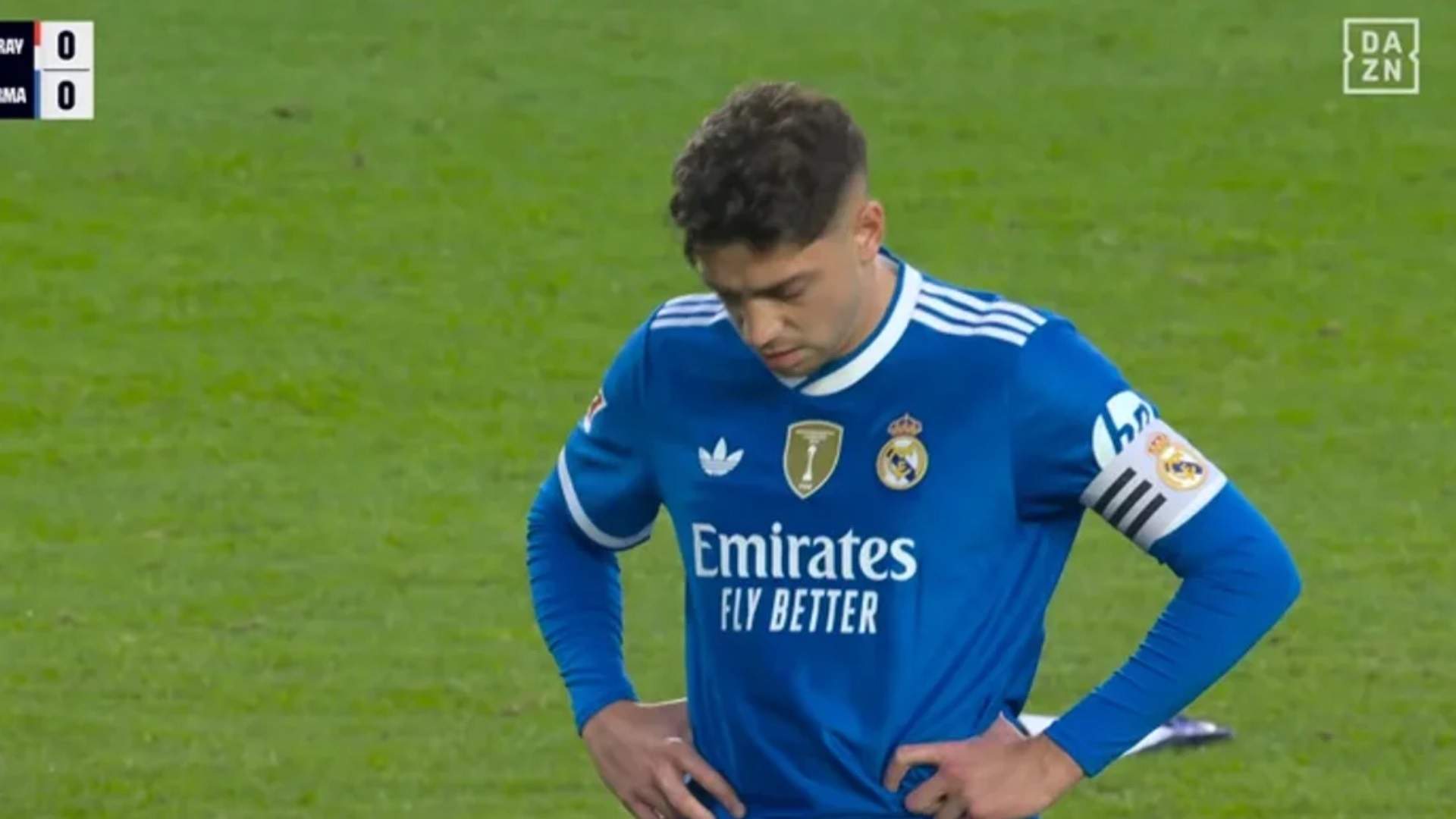 ¿Qué lesión tiene Fede Valverde?: preocupación en el Real Madrid 