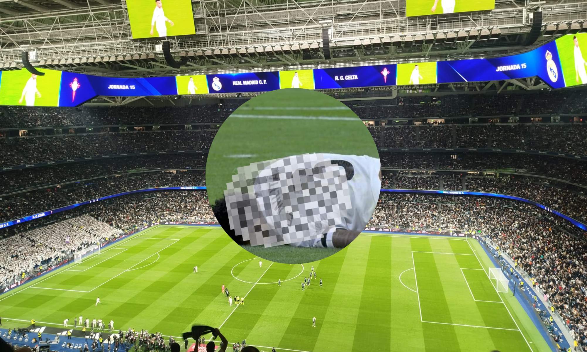 Lesión de un titular ante de medirse al City